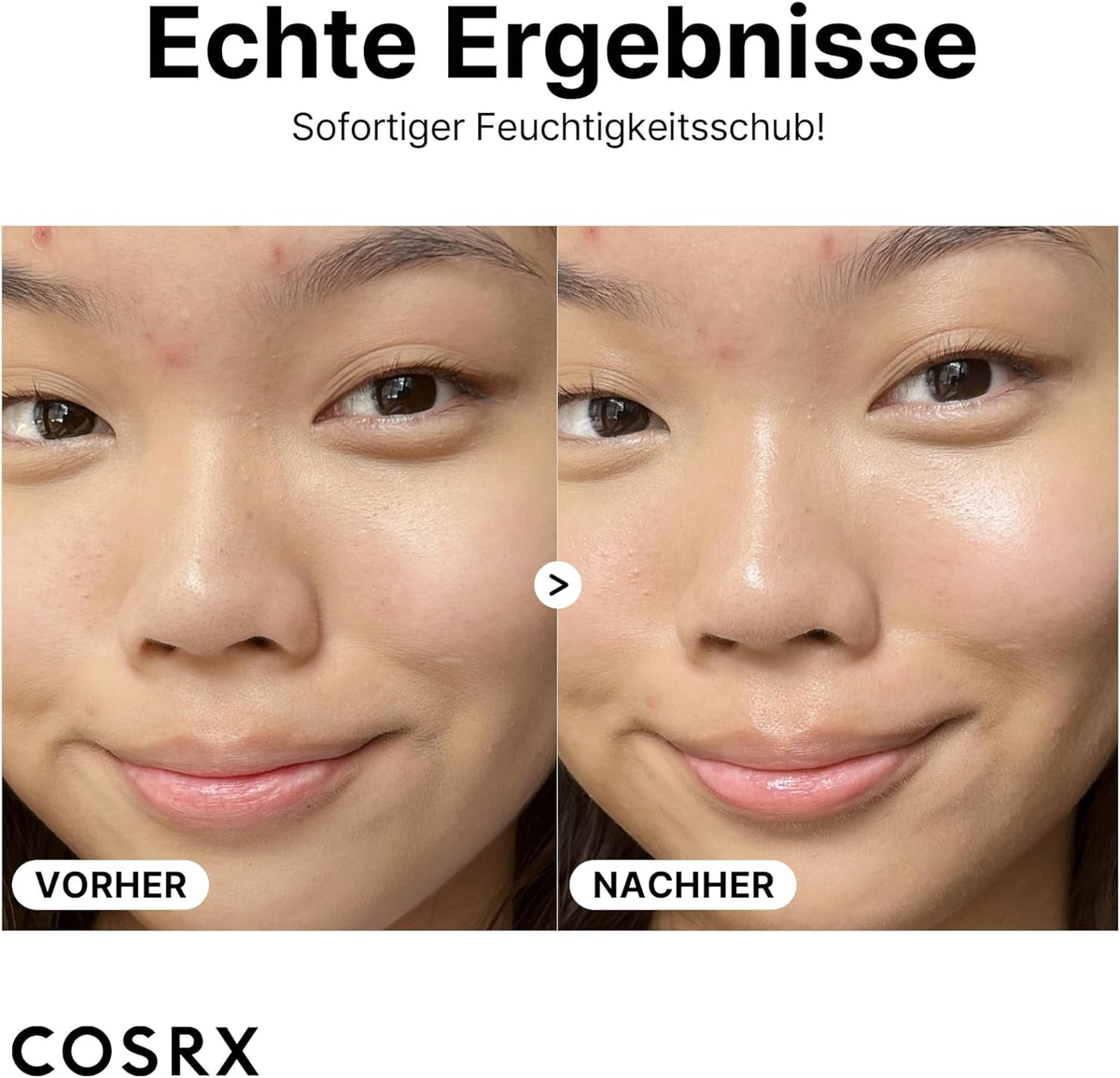 COSRX - The Hyaluronic Acid 3 - 20ml
