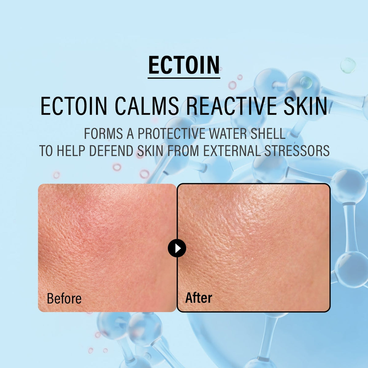 EPII - Double Up Cream ECTOIN & PANTHENOL - 50ml