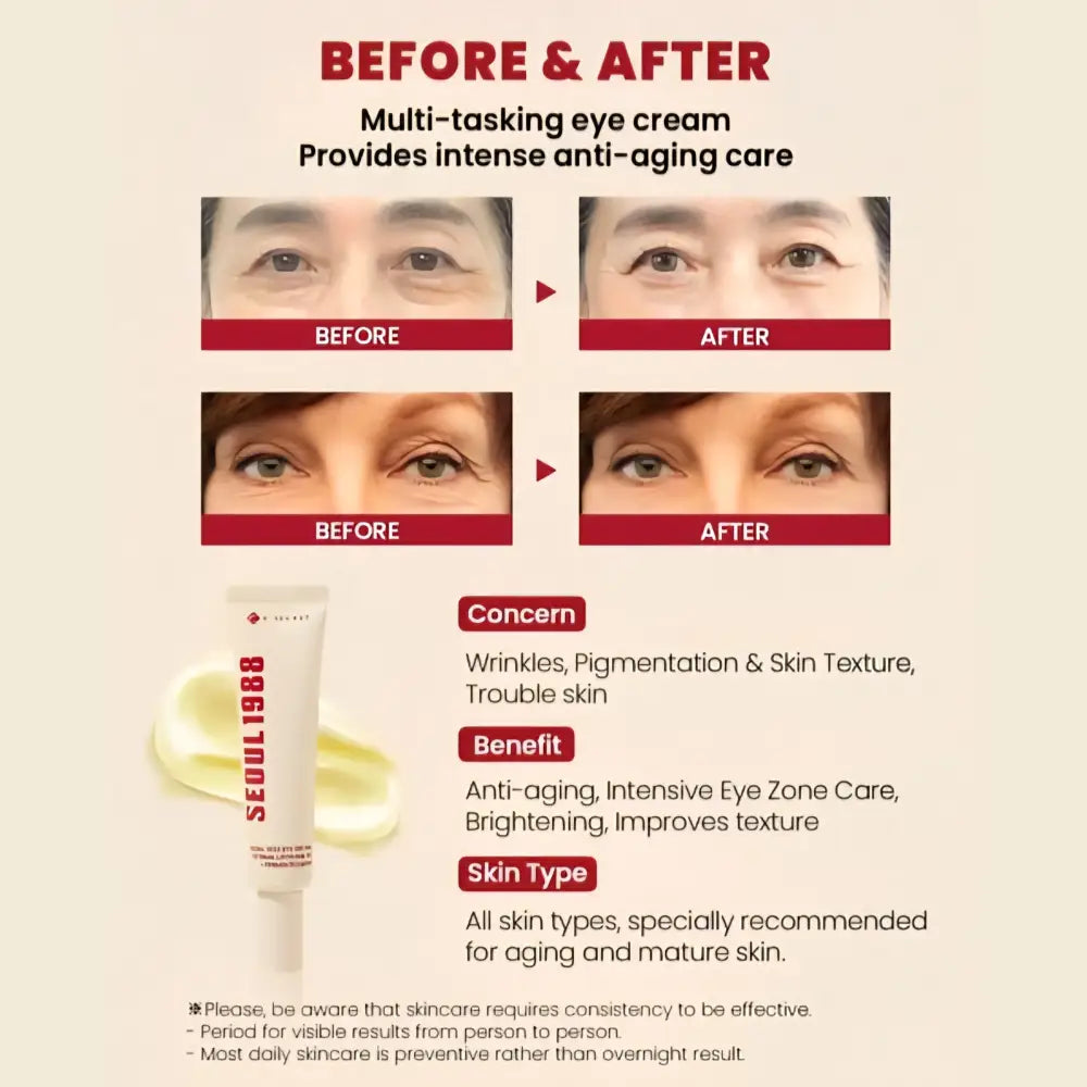 KSECRET SEOUL 1988 Eye Cream Retinal Liposome 4% + Fermented Bean 30ml
