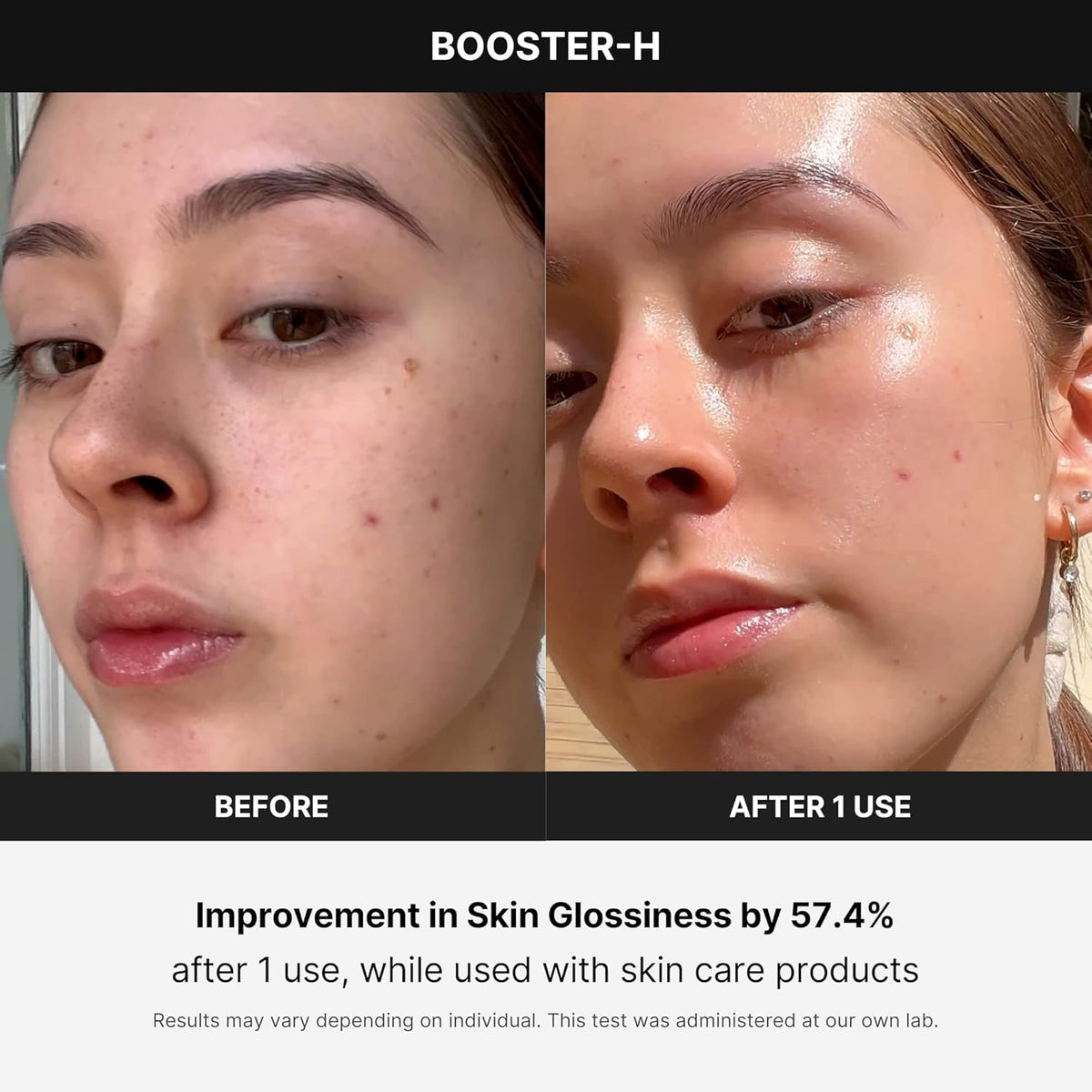 MEDICUBE - AGE-R Booster Pro - Appareil de Soin Visage