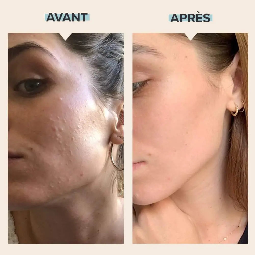 paulas-choice-mini-skin-perfecting-2-bha-lotion-exfoliante-30-ml