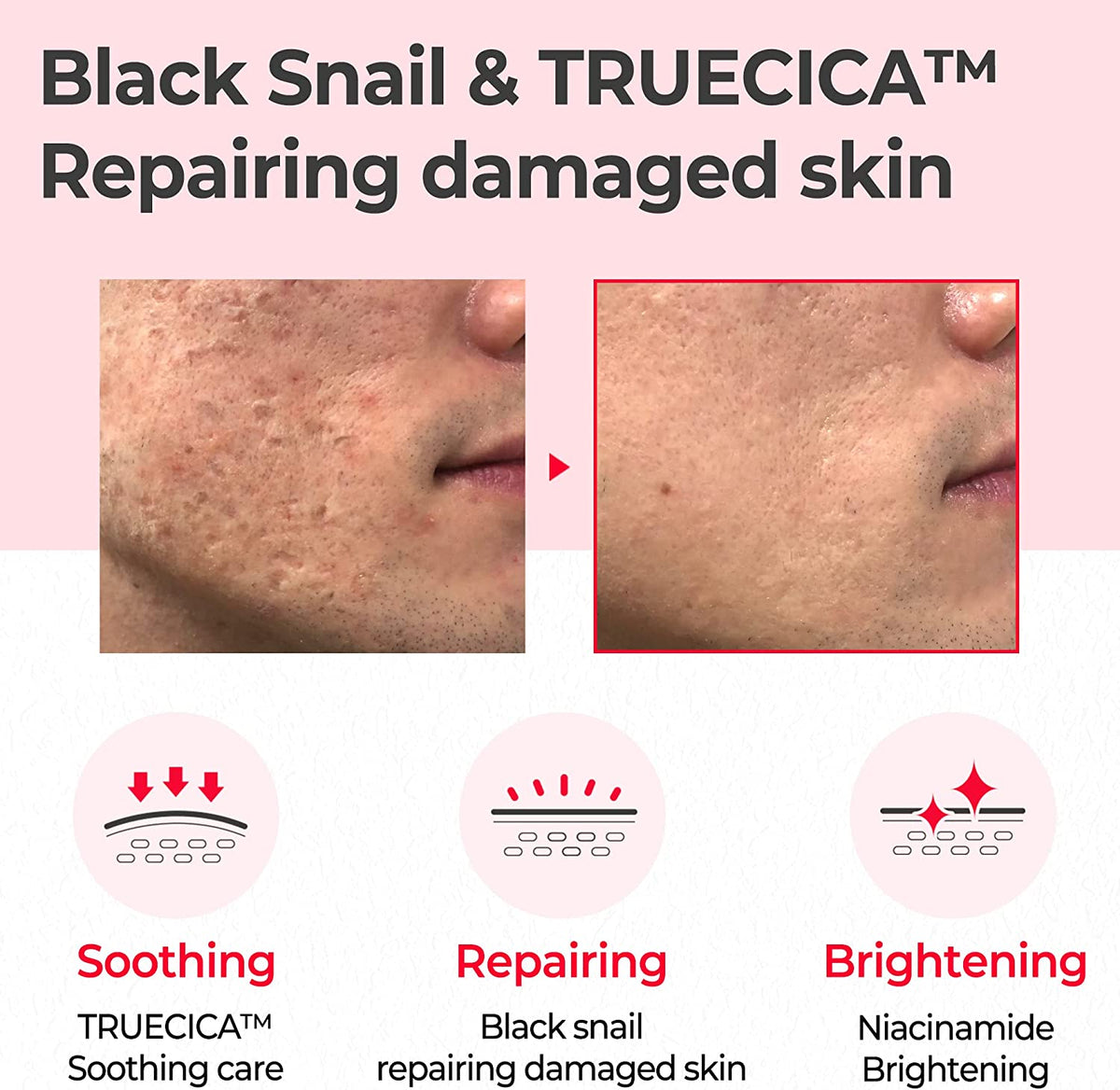 some-by-mi-snail-truecica-miracle-repair-toner-135ml