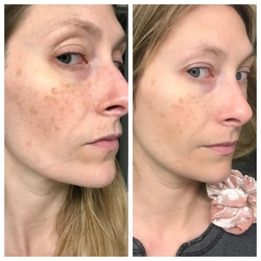 the-ordinary-retinol-1-in-squalane-30ml